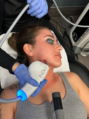 Moxi Is Safe For All Skin Types